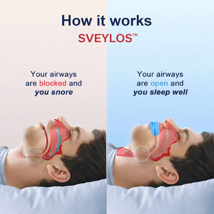 SVEYLOS™ Anti-Snoring Device